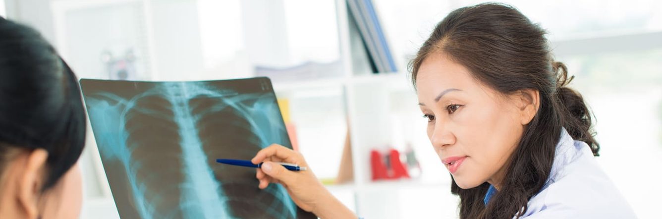 Female doctors examining x-ray