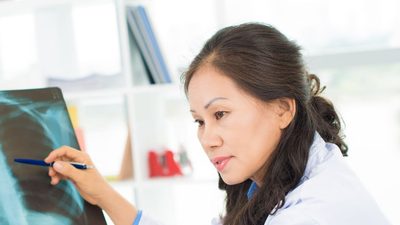 Female doctors examining x-ray